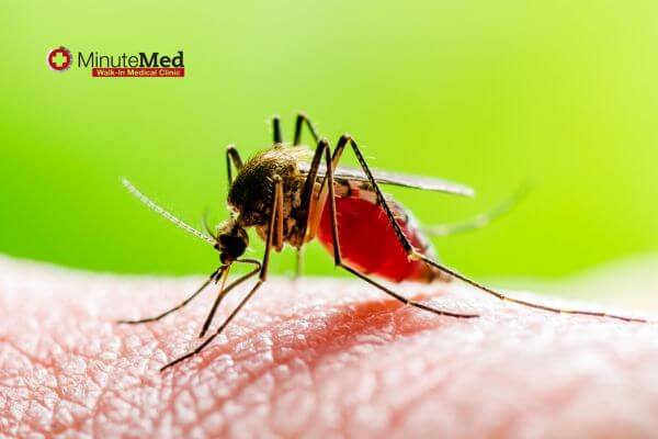 The Ultimate Guide to Treating and Preventing Insect Bites | MinuteMed ...